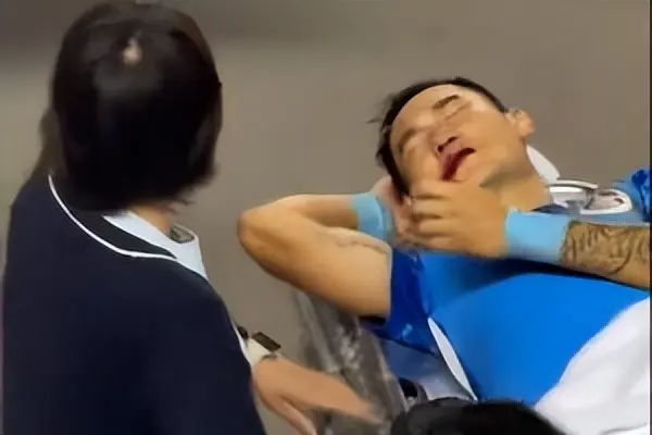 img, 完成了鼻骨, 然而长春亚